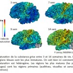 Assessment of the early organization and maturation of infants’ cerebral white matter fiber bundles