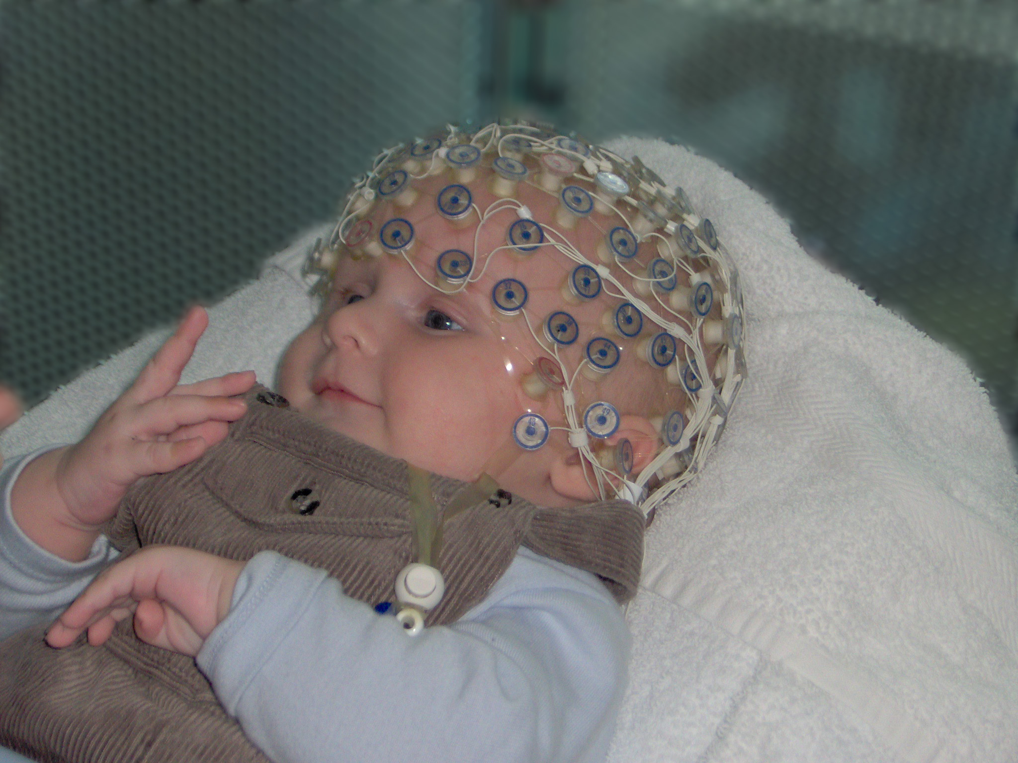 L'Electro-Encephalographie (EEG)